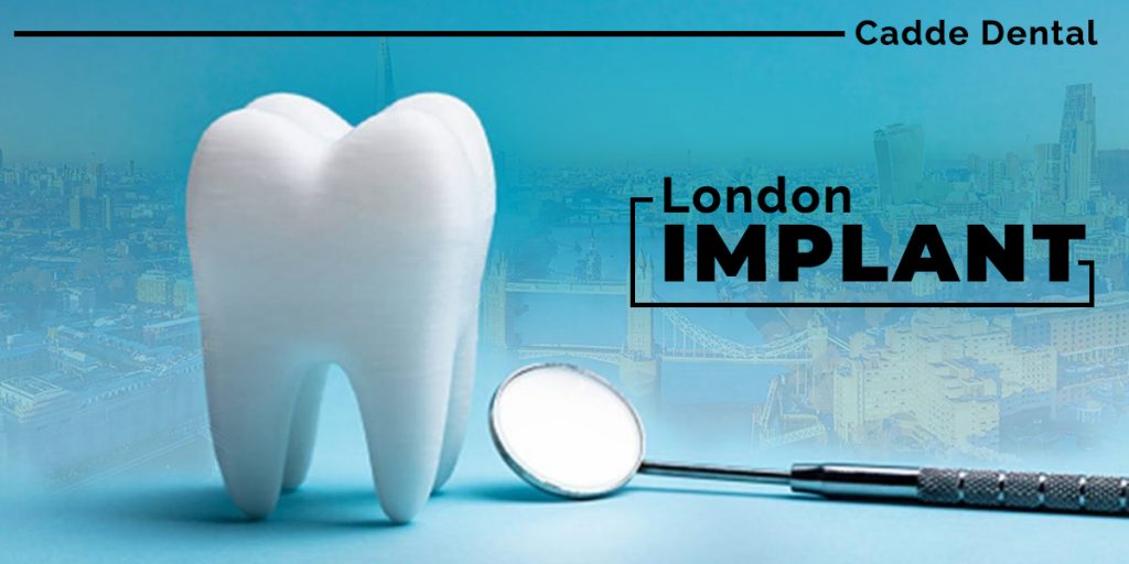 London Implant