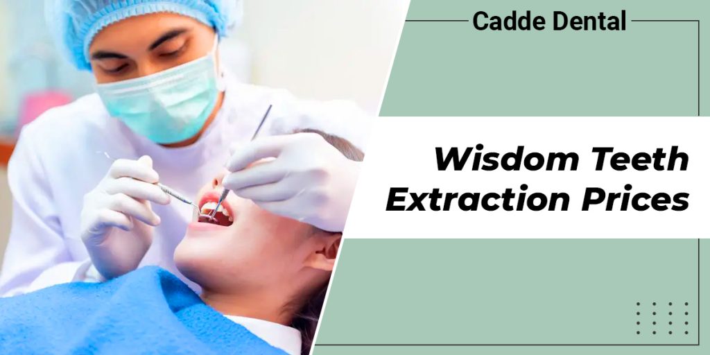 Wisdom Teeth Extraction Prices