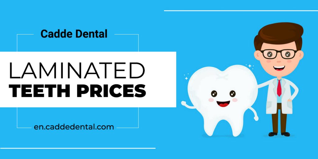 Laminated Teeth Prices