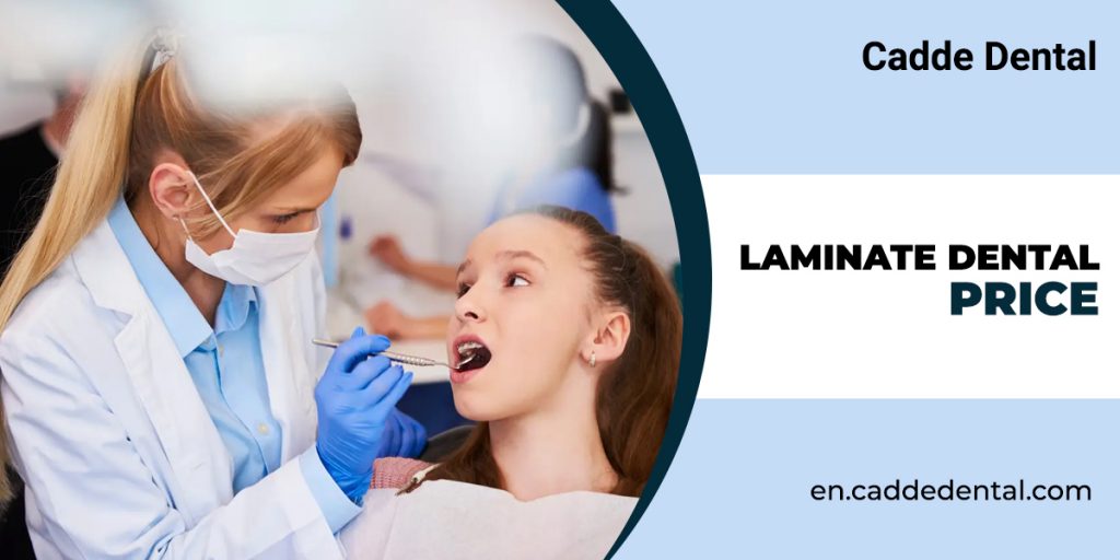 laminate dental price