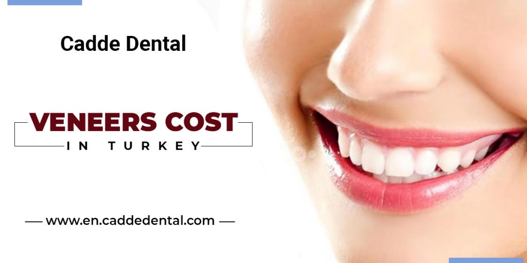 Veneers cost in Turkey