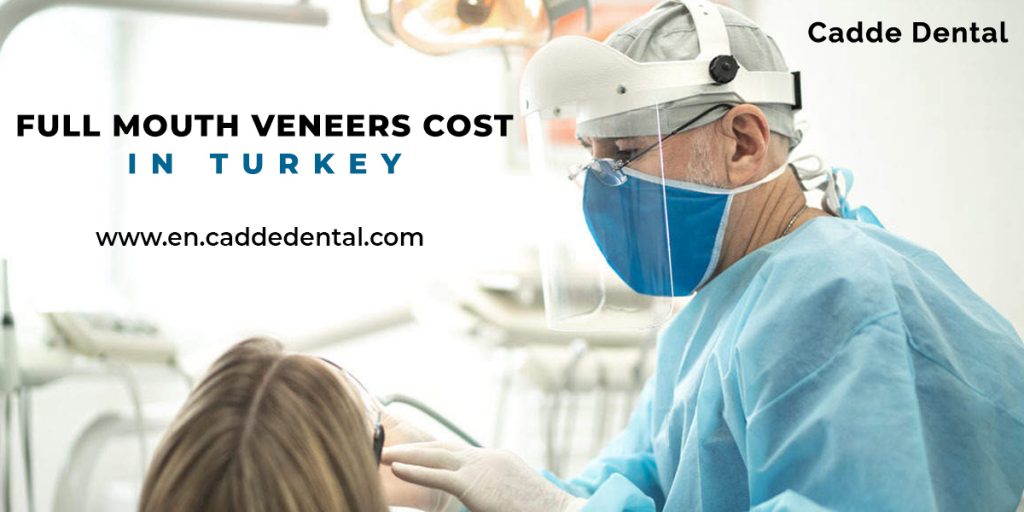 full mouth Veneers Cost in Turkey