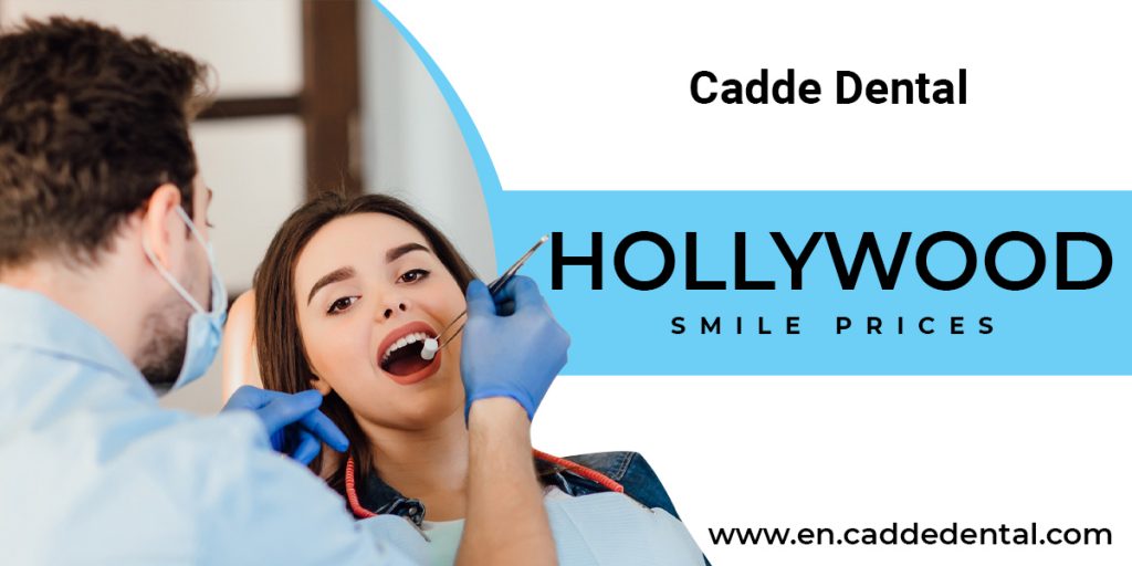 Hollywood smile prices