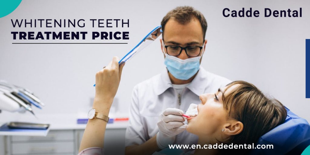 whitening teeth treatment price