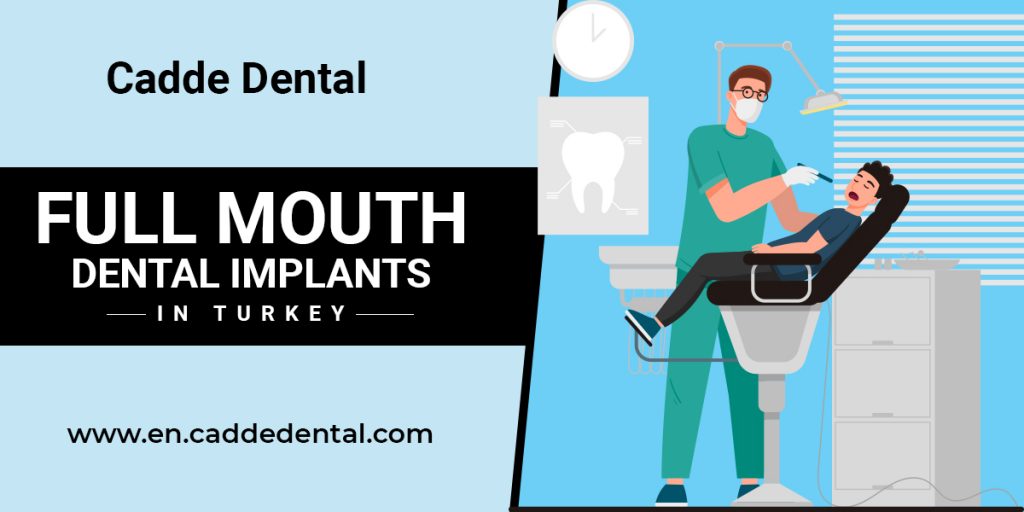 full-mouth dental implants in Turkey