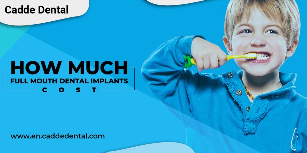 How Much Full Mouth Dental Implants cost