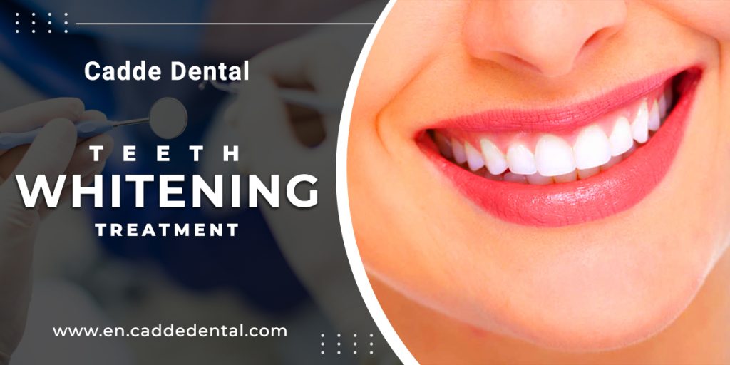 Teeth Whitening treatment in Turkey