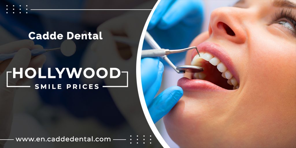 Hollywood Smile Prices