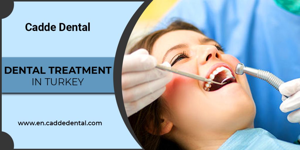 dental treatment in Turkey