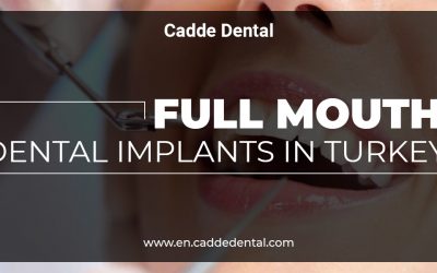 full mouth dental implants in Turkey