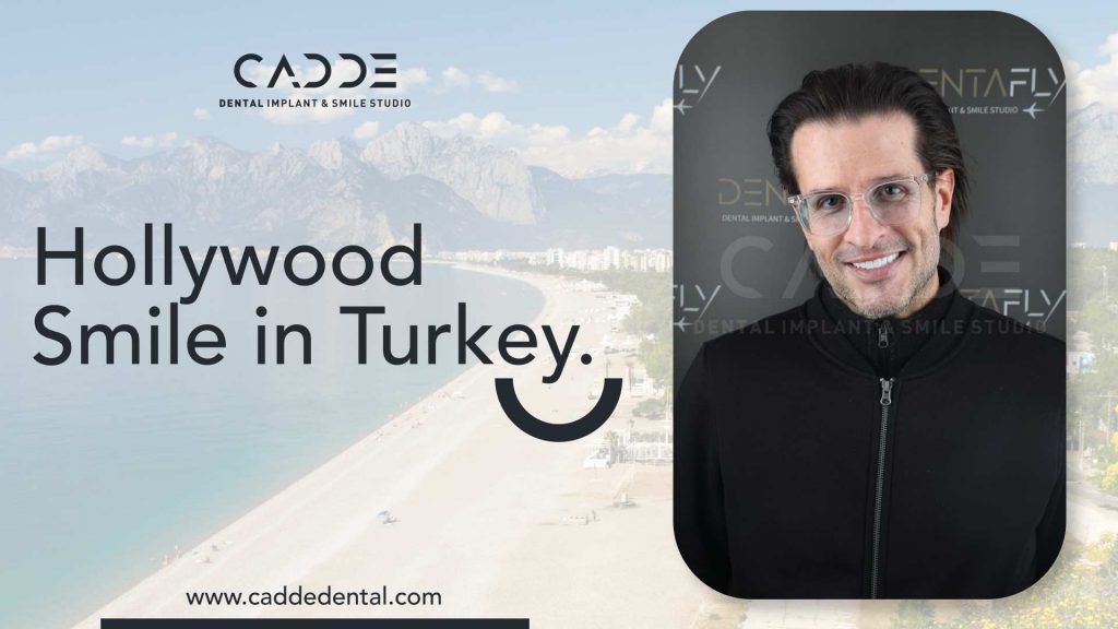 hollywood smile design in Turkey