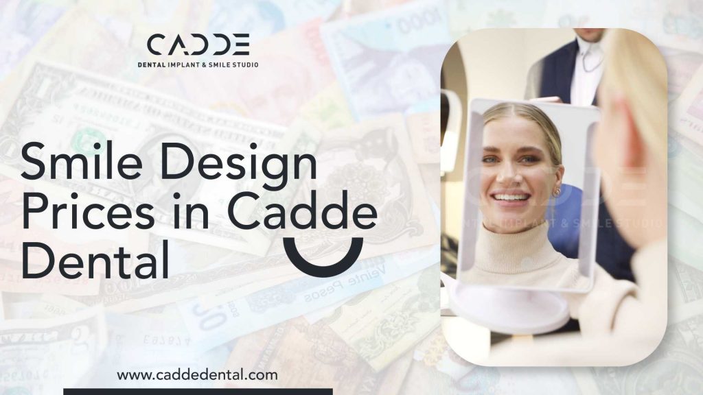 smile design prices in cadde dental