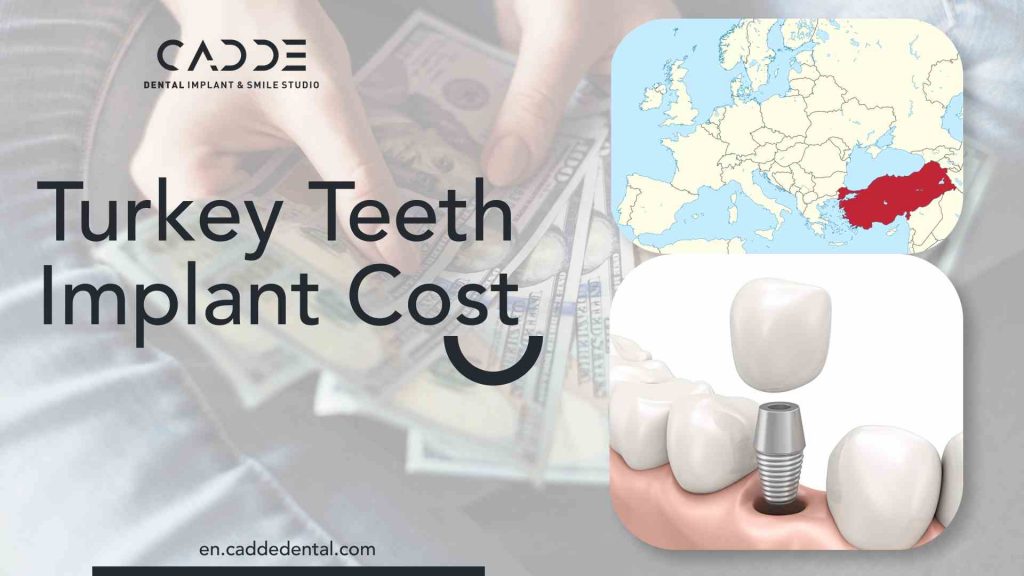 Turkey teeth Implant cost