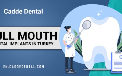 Full Mouth Dental Implants in Turkey