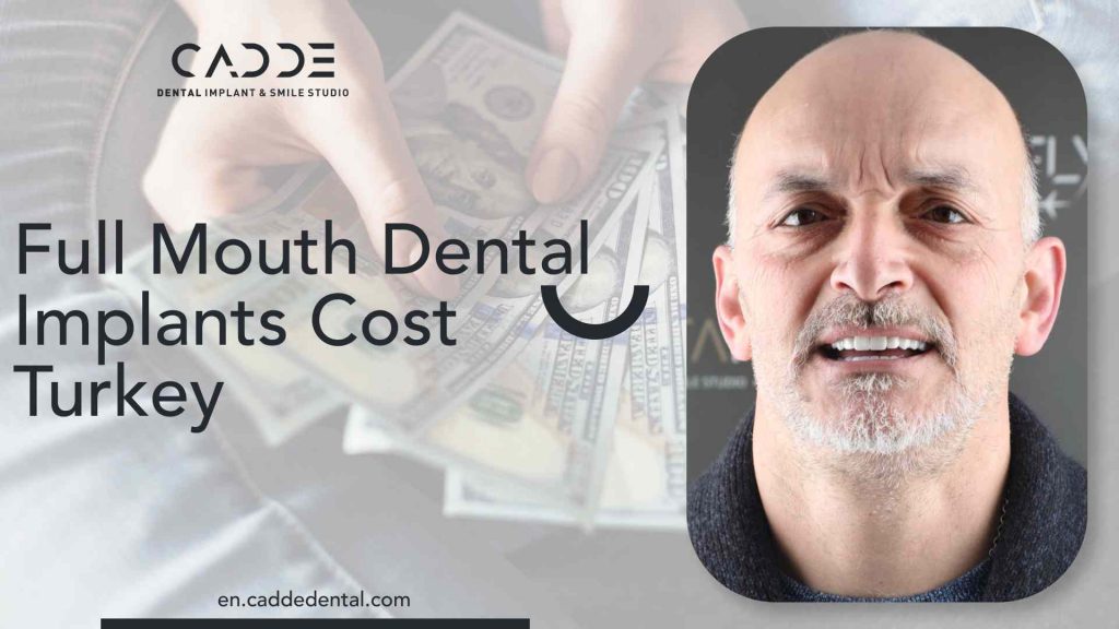 full mouth dental implants cost in Turkey
