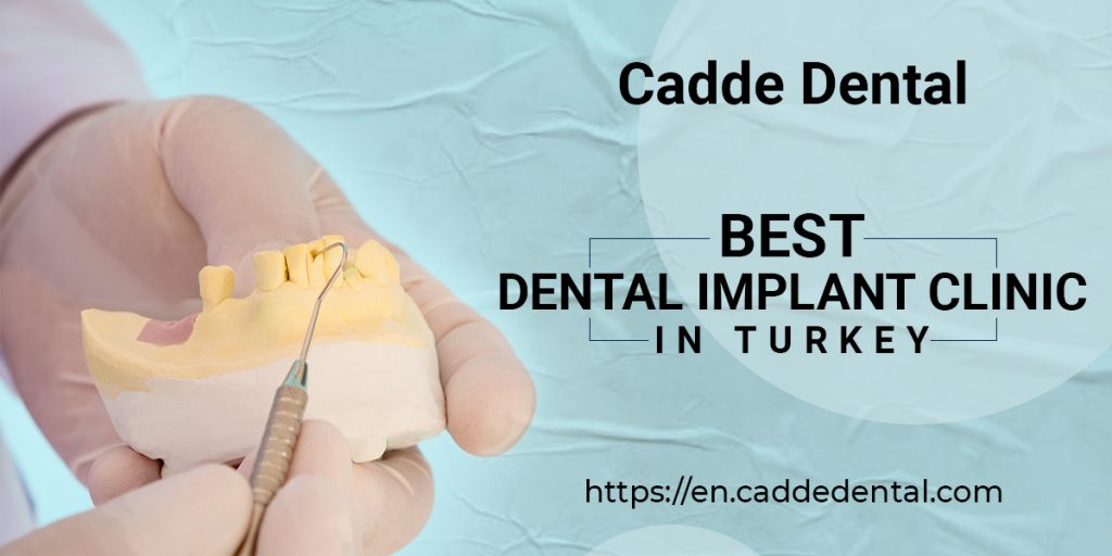 Best Dental Implant Clinic in Turkey