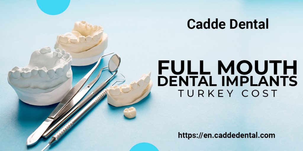 Full Mouth Dental Implants Turkey Cost