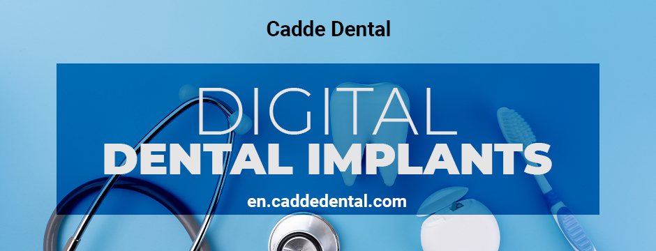 Digital Dental Implants