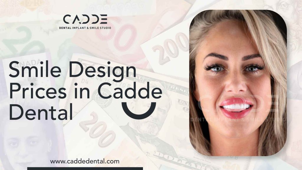 smile design prices in cadde dental. Cosmetic dental operations prices.