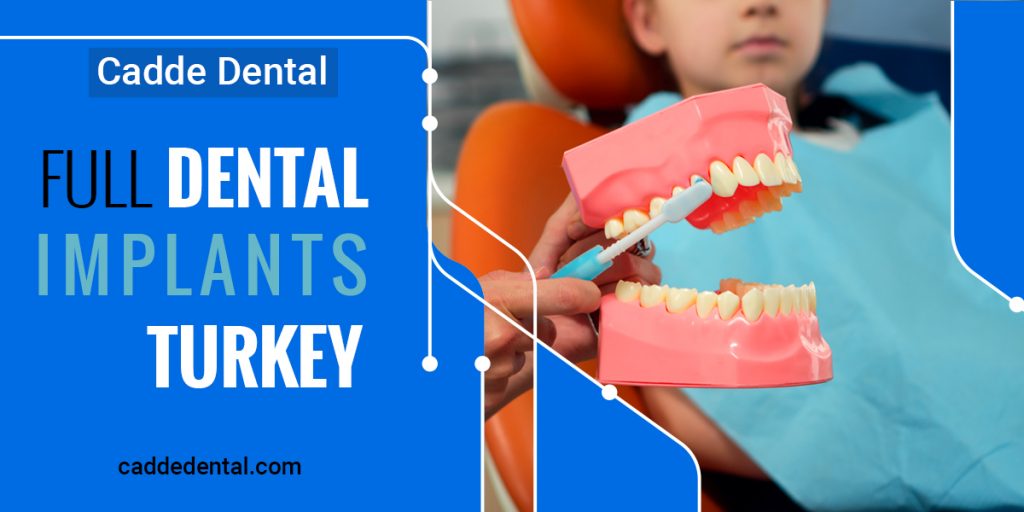 Full Dental Implants Turkey